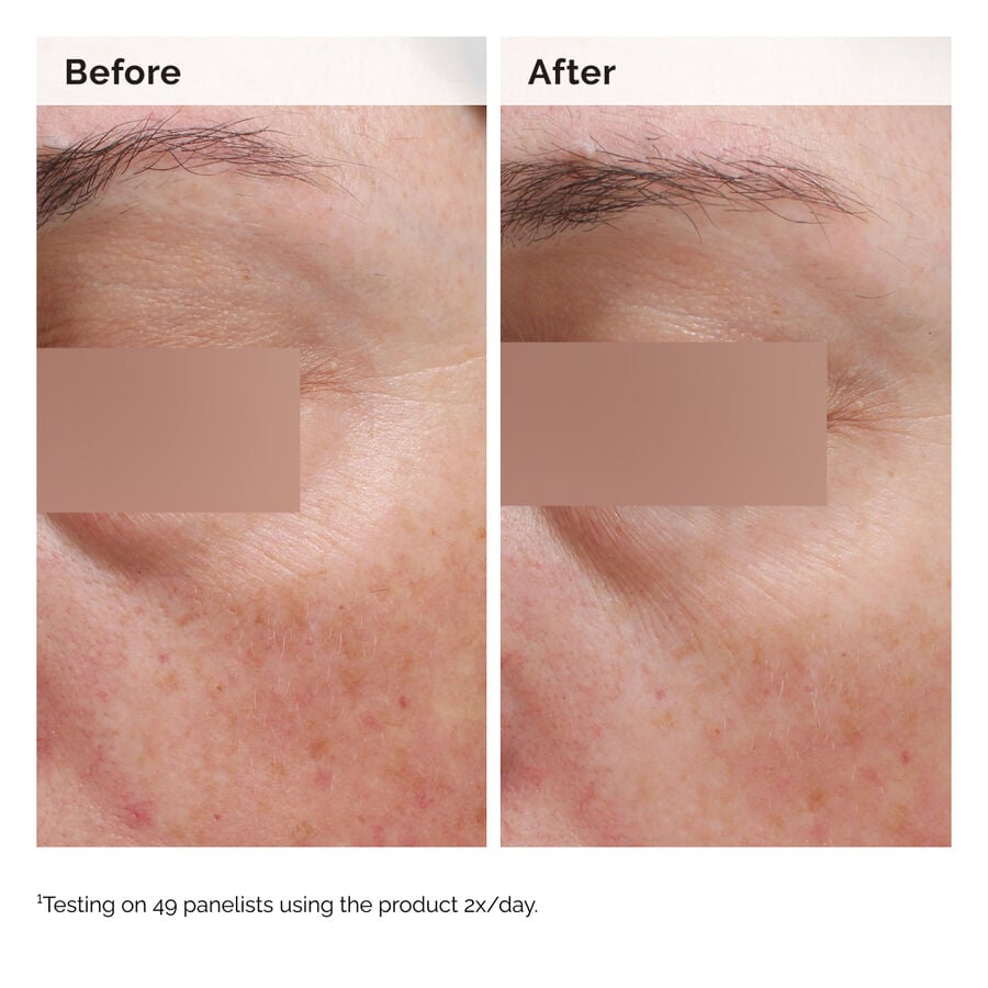 niacinamide-5-face-and-body-emulsion-u5 2024-08-23-ORD-Nia-5pct-Face-Body-B-A-Elasticity-Global-02-1x1.jpg