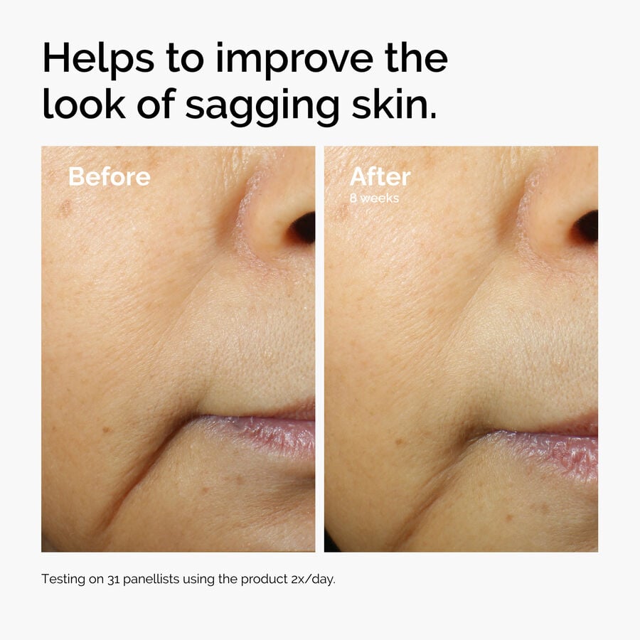 caffeine-3-escin-1-face-serum-n9 ord-caffeine-3pct-escin-1pct-face-serum-before-after-sagging.jpg