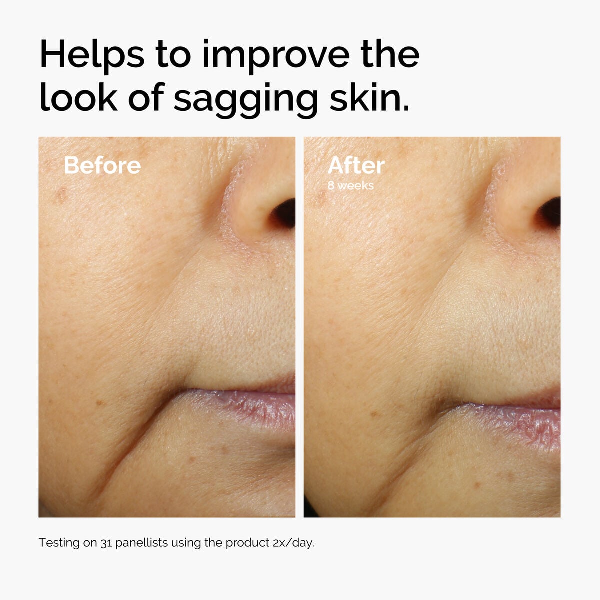 caffeine-3-escin-1-face-serum-n9 ord-caffeine-3pct-escin-1pct-face-serum-before-after-sagging.jpg