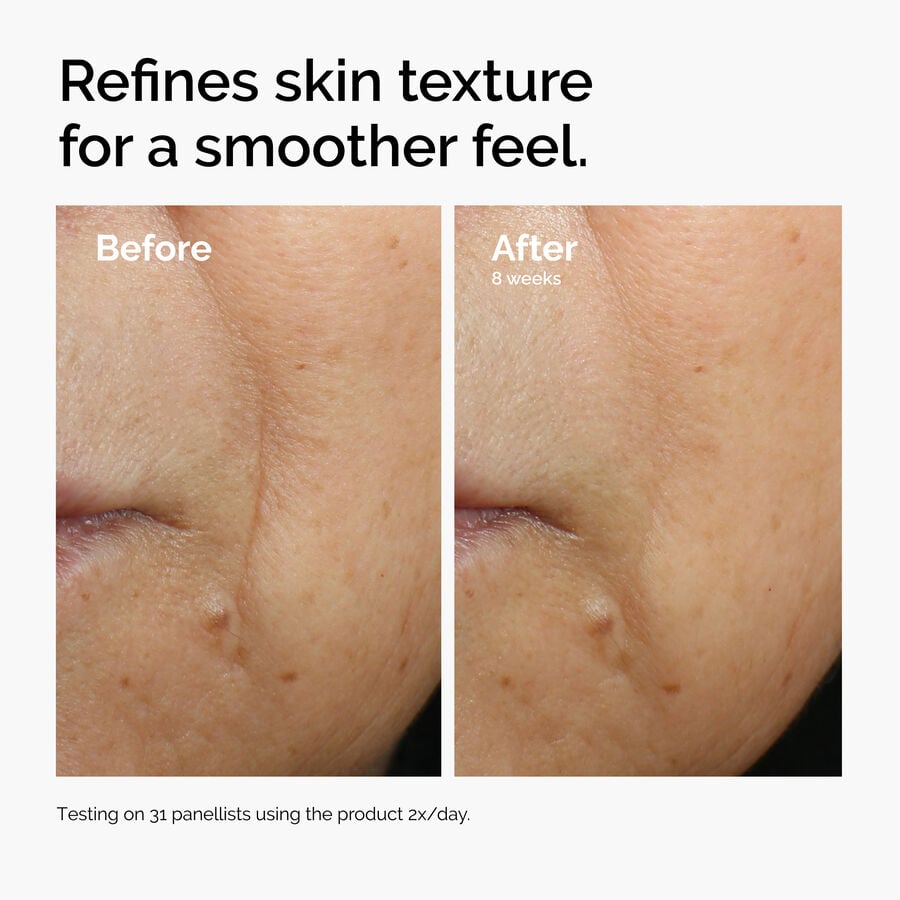 caffeine-3-escin-1-face-serum-n9 ord-caffeine-3pct-escin-1pct-face-serum-before-after-texture.jpg