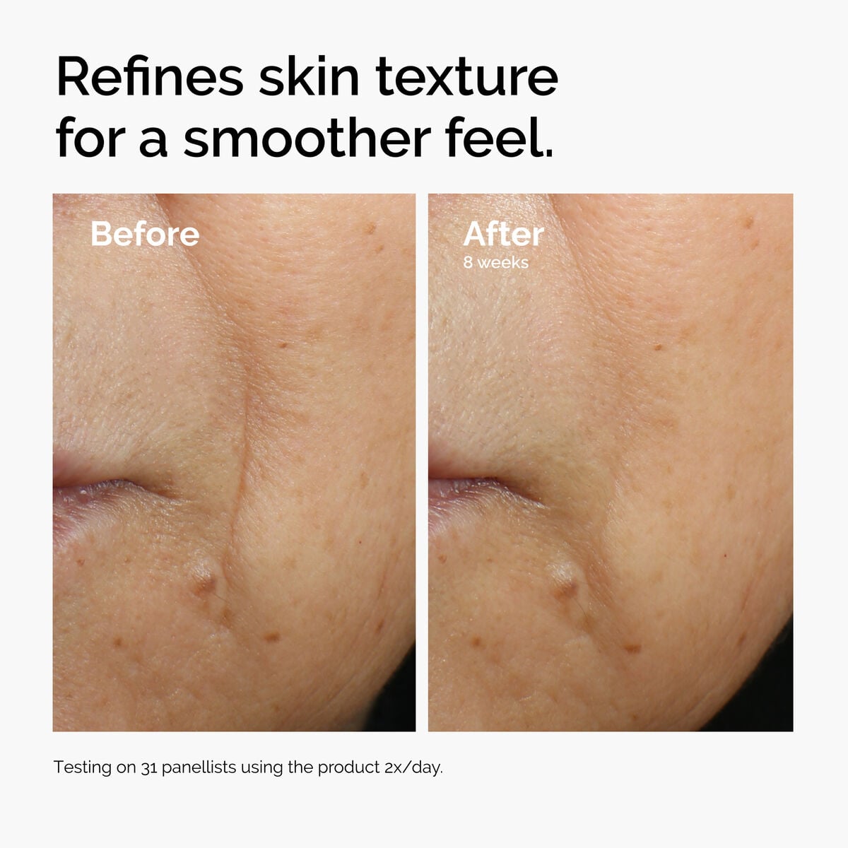 caffeine-3-escin-1-face-serum-n9 ord-caffeine-3pct-escin-1pct-face-serum-before-after-texture.jpg