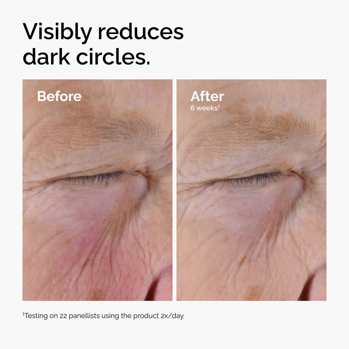 caffeine-solution-5-egcg-eye-serum-s6 ord-caffeine-solution-egcg-dark-circles-before-after.jpg