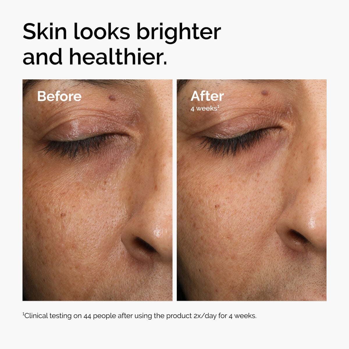 multi-antioxidant-radiance-serum-h7 ord-mars-before-after-healthy.jpg