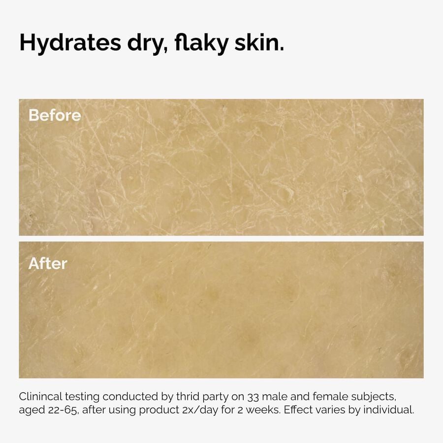the-body-care-collection-t5 ord-natural-moisturizing-factors-inulin-body-before-after-graphic-02.jpg