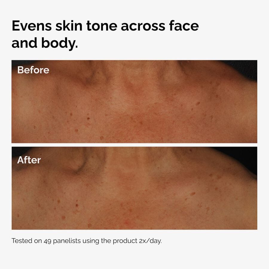 the-body-care-collection-t5 ord-niacinamide-face-body-serum-before-after-even-tone-graphic.jpg