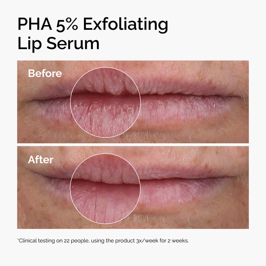 pha-5-exfoliating-lip-serum-s9 ord-pha-5pct-lip-exfoliating-serum-before-after.jpg