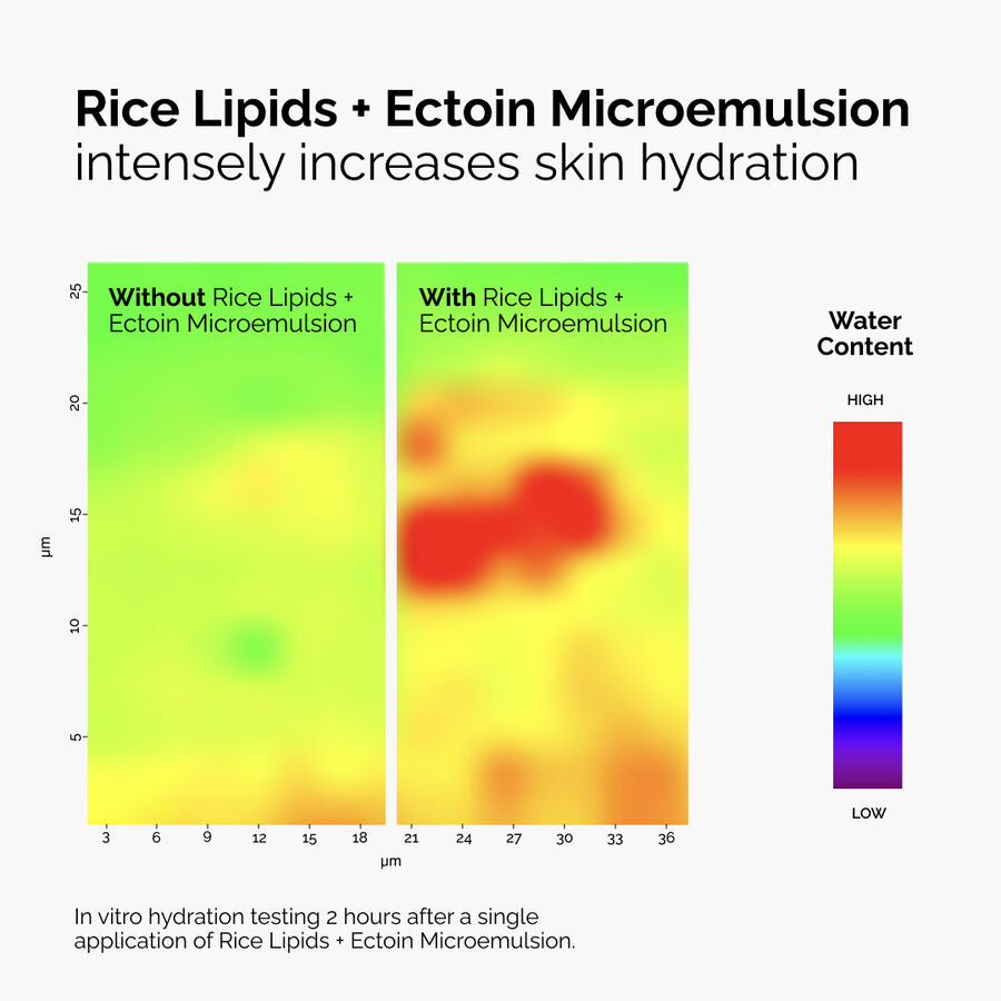 rice-lipids-ectoin-microemulsion-m2 ord-rice-lipids-ectoin-microemulsion-thermal-before-after.jpg